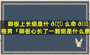 脚板上长痣是什 🦊 么命 🌸 格男「脚板心长了一颗痣是什么原因」
